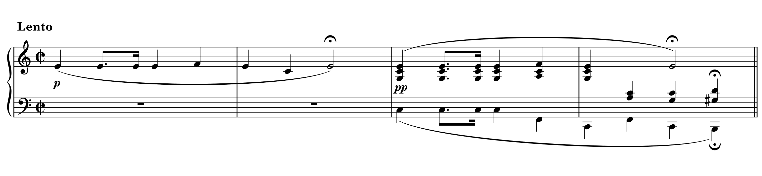Excerpt of Etude in A Minor Op. 25, No. 11